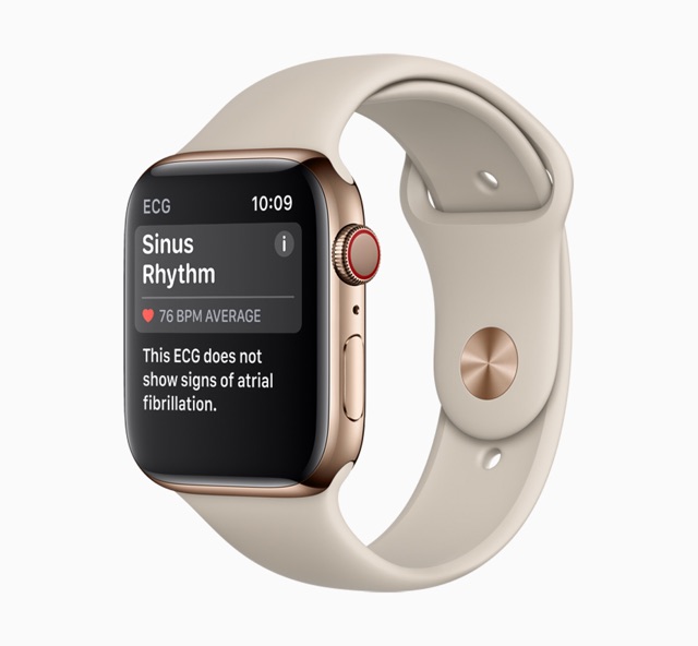 Apple Watch Now Detects Irregular Heart 
